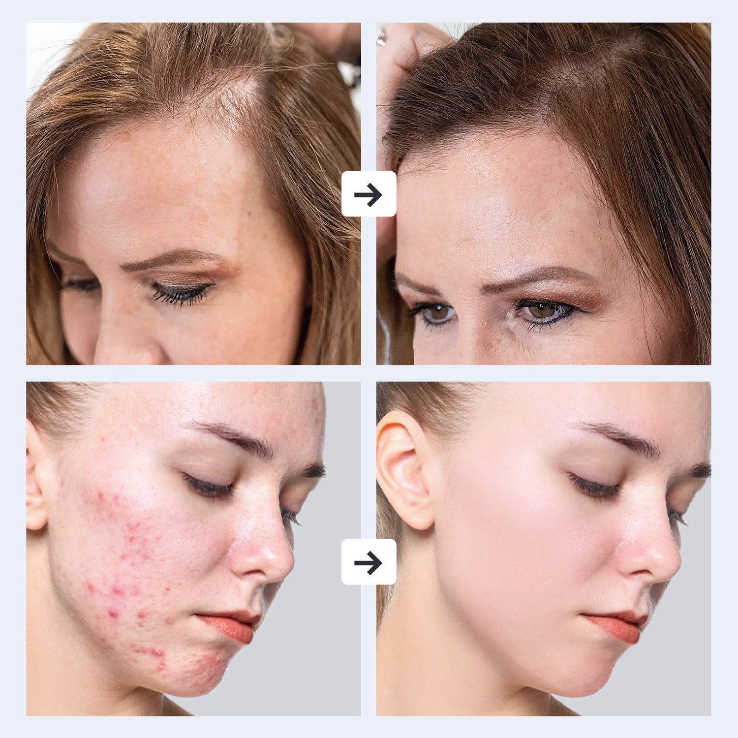 Masajeador GESS DARS Alta Frecuencia 2 en 1: Terapia Profesional Facial y Cuero Cabelludo